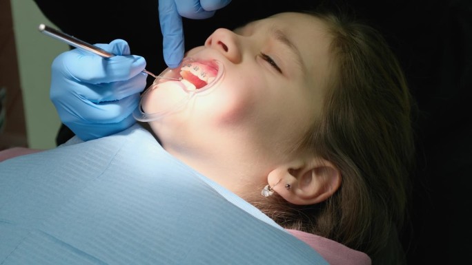 牙医给一个小女孩装牙套。