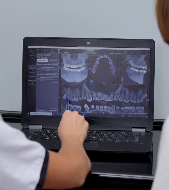 医生在诊所展示植牙病人的x光片
