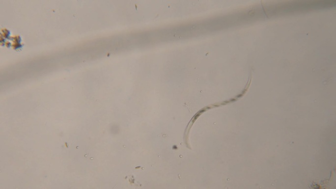 显微镜下饮用水中的细菌、寄生虫和蠕虫。显微镜下的线虫，蛔虫中的寄生虫:蛔虫，蛲虫，旋毛虫。环境污染。