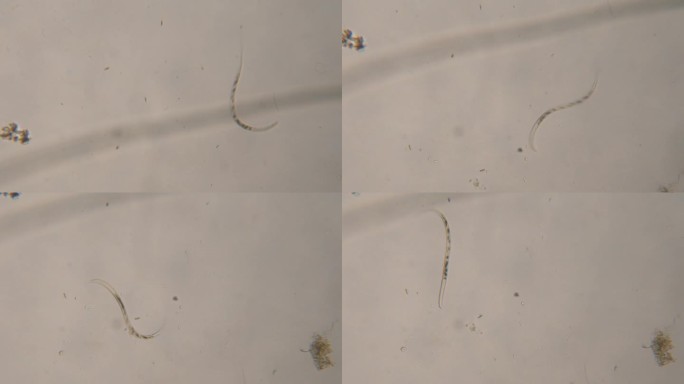 显微镜下饮用水中的细菌、寄生虫和蠕虫。显微镜下的线虫，蛔虫中的寄生虫:蛔虫，蛲虫，旋毛虫。环境污染。