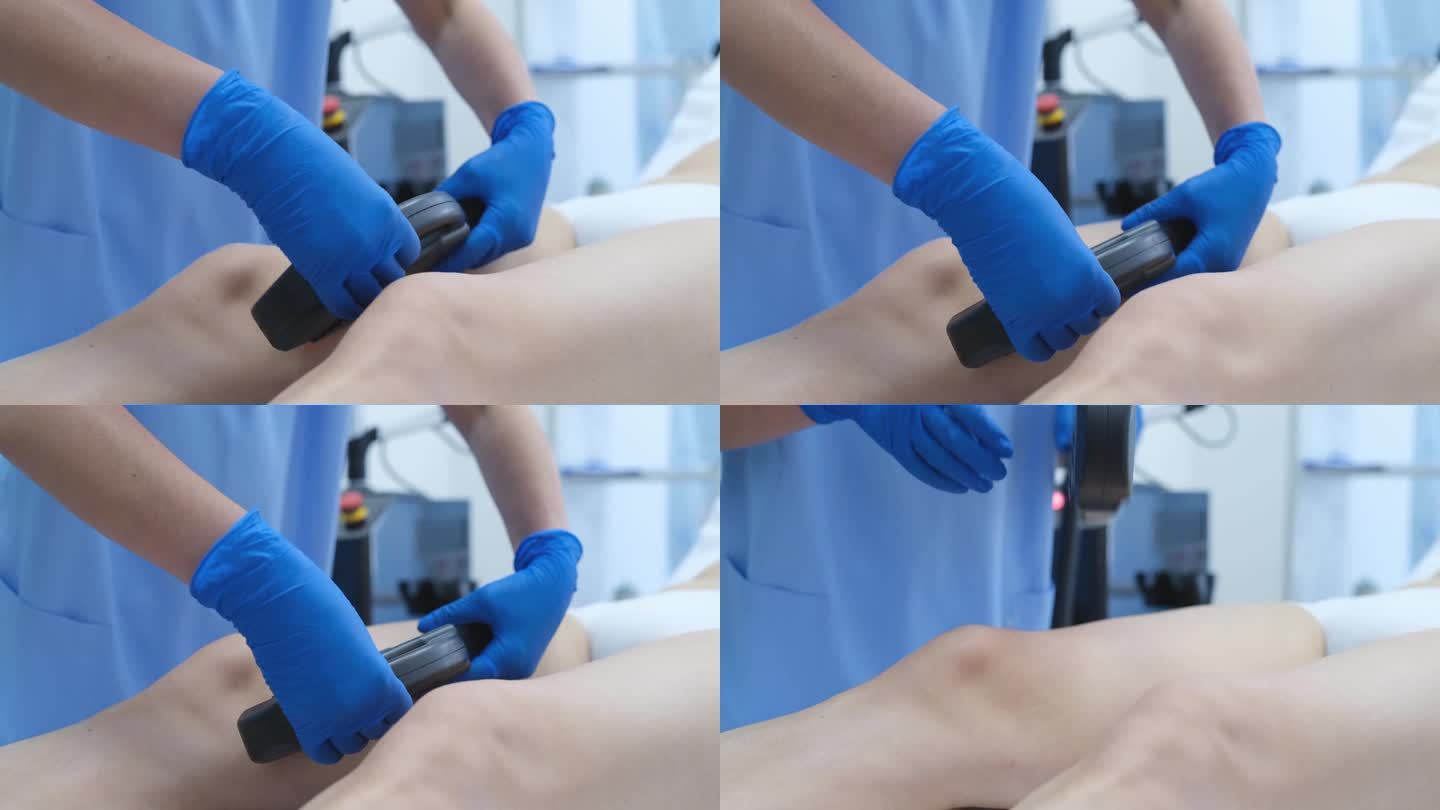 医生用激光切除腿部的血管