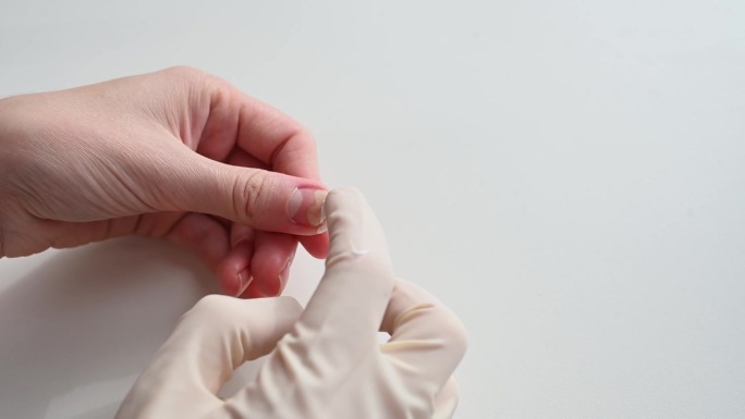 医生检查并将药膏涂在受影响的指甲上——甲溶症，特写。足学概念