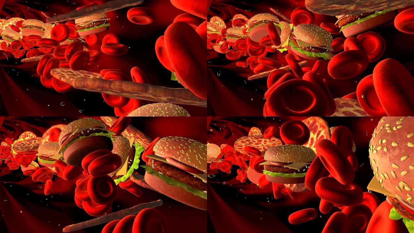 胆固醇堵塞动脉，医学上的概念是指人体血管因不健康的饮食而堵塞，存在肥胖或节食等健康风险和营养问题