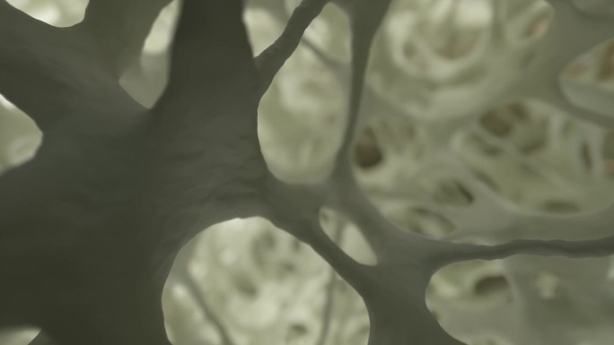 逼真的3D动画，摄像机移动在光线充足的海绵状骨组织上，类似于电子显微镜的图像。