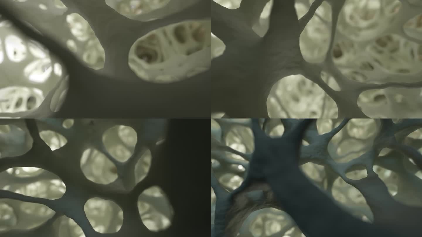 逼真的3D动画，摄像机移动在光线充足的海绵状骨组织上，类似于电子显微镜的图像。