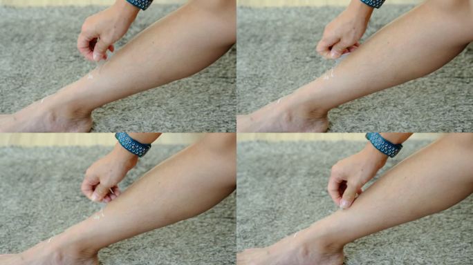 一个女人的手正在剥去干燥的皮肤。皮肤问题