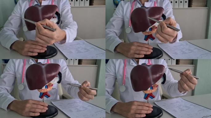 肝内科医生在人体肝脏解剖模型上展示胆囊和胆管