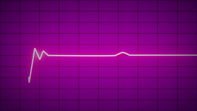 紧急心电图仪发光霓虹灯心脏脉搏心跳心电图图粉红色背景。