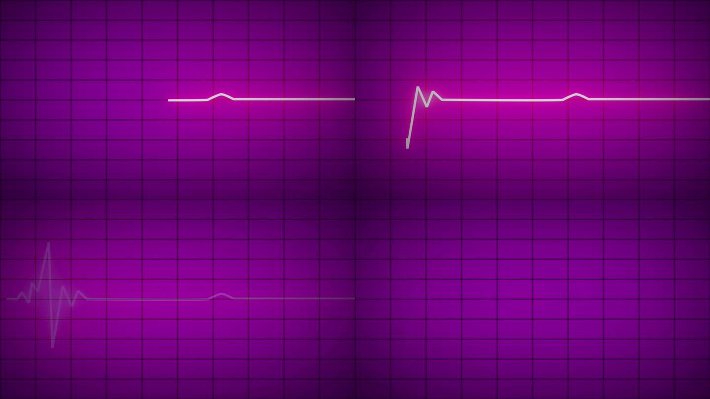 紧急心电图仪发光霓虹灯心脏脉搏心跳心电图图粉红色背景。