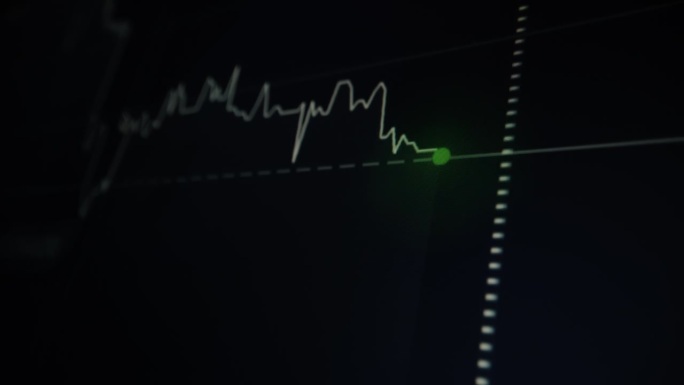 股票市场图形屏幕监视器与点的上升和下降的价格或心电图心电图在病人监护