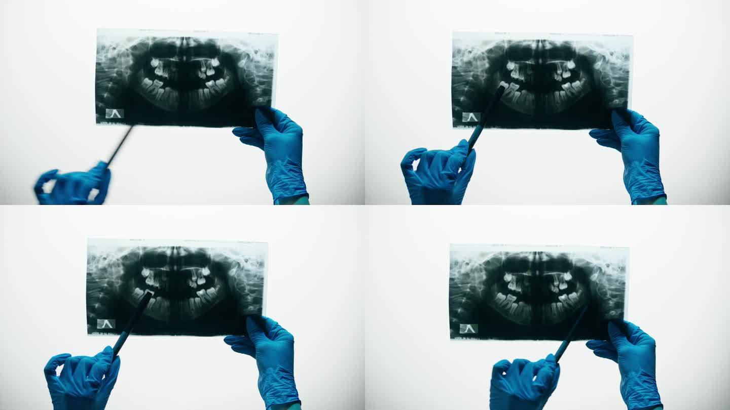 下巴x光特写。牙齿的核磁共振图像。医生正在检查牙齿的x光片。医疗保健和医学，牙科，口腔科的概念。