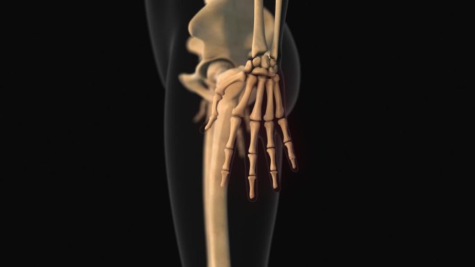 掌骨和指骨骨痛的医学动画