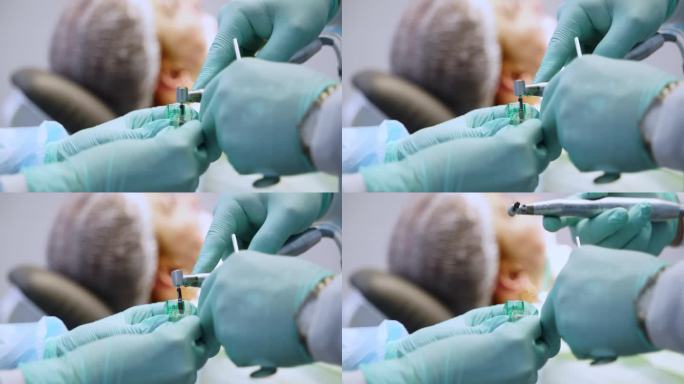 现代牙科诊所植牙手术中，牙医拿植牙的手。植入手术正在进行中。钛植入。安装植牙。特写镜头。