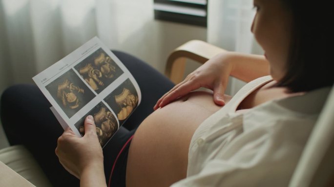 年轻的孕妇在看她未出生婴儿的超声波扫描