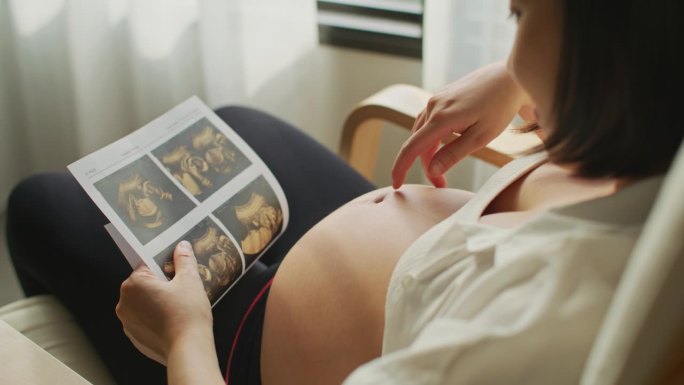 年轻的孕妇在看她未出生婴儿的超声波扫描