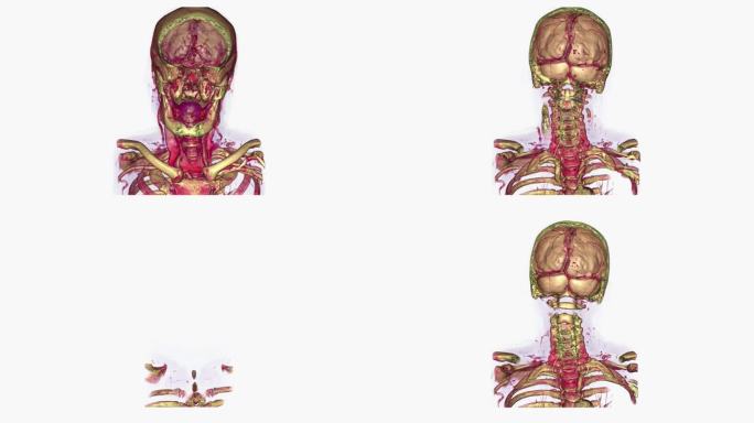 人死后头部形状变化的x射线扫描图