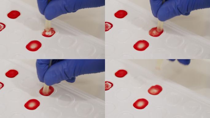 血球凝集法检测血型和rh因子