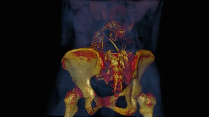 婴儿与母亲骨盆骨的X光扫描