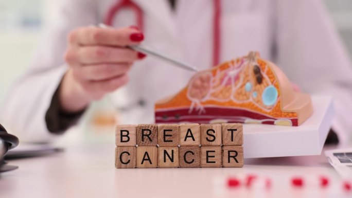 乳腺医生手中的乳腺癌模型解剖征象
