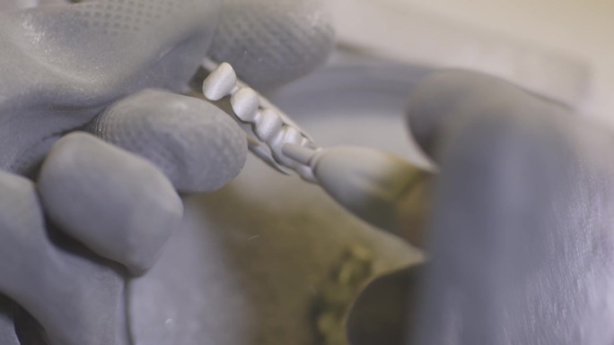 牙科技师用喷砂机抛光人造陶瓷牙。