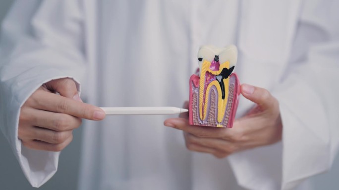 牙医与牙齿解剖模型。口腔蛀牙和疾病，刮掉牙垢。三月口腔健康，牙医日，假牙。牙痛及儿童牙齿健康月及正畸