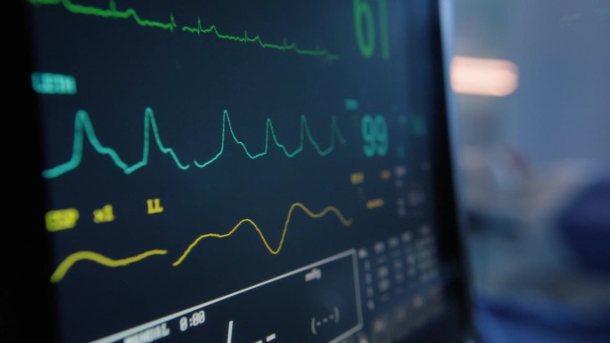 医疗保健，心电图和监护与屏幕在医院的心率，生命体征和心电图。心脏、心脏病和心血管健康的医疗、设备和电