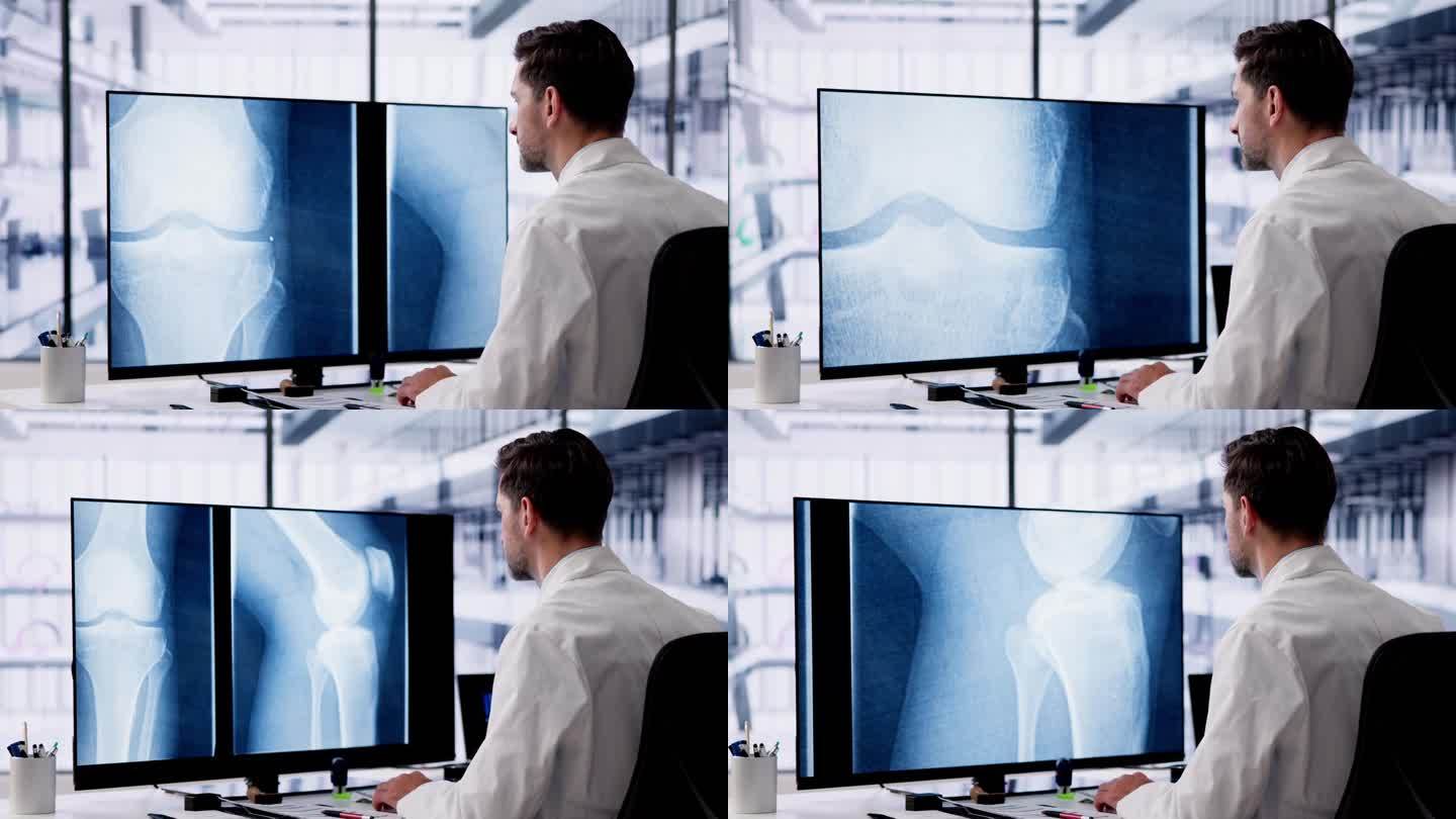 医生筛查膝关节X光片