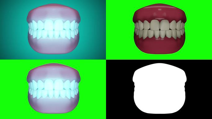 牙齿美白与激光或蓝光3D动画
