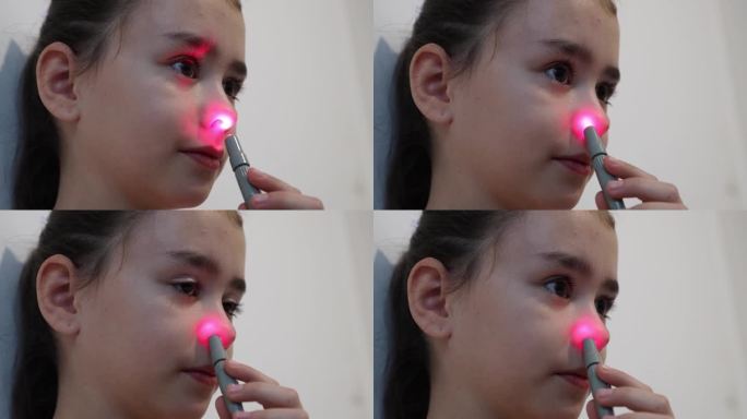 小女孩用红外线治疗鼻子。
