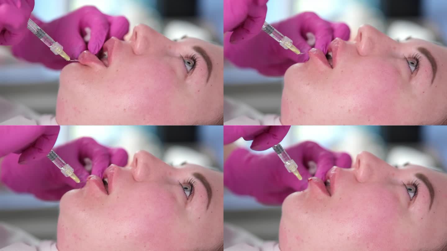 唇部注射手术。专业美容院的年轻女病人。理念注射，美容服务。