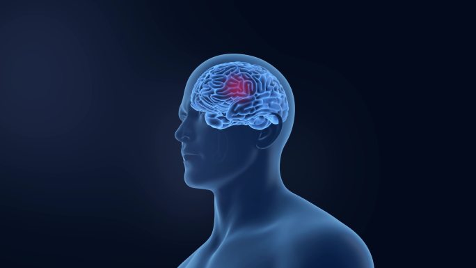 大脑结构脑健康 头痛偏头痛