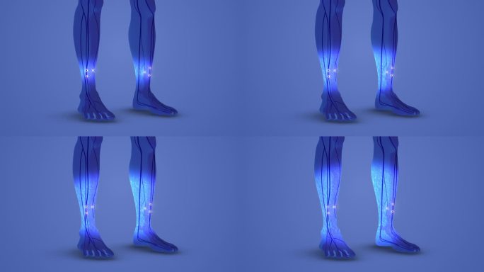 足部腕管综合征麻木的医学概念
