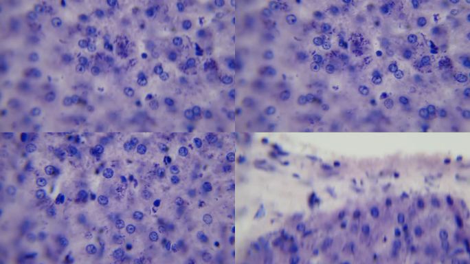 显微镜下的肝脏。维生素代谢和中和。400 x放大。不朽。肝脏是干细胞的来源。肝炎和艾滋病毒。肝细胞