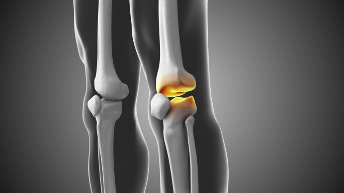 膝关节疼痛与间隙医学动画