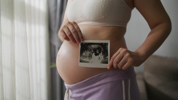 年轻的孕妇拿着一张婴儿腹部的超声波照片