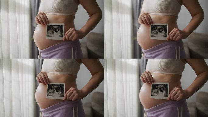 年轻的孕妇拿着一张婴儿腹部的超声波照片
