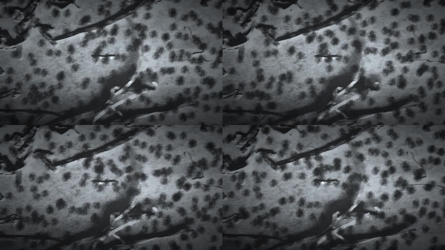 黑白显微镜视图，展示了许多不规则形状的细菌集群，以不同的密度分散在视野中