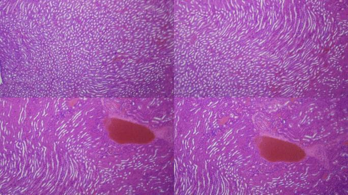 医学研究。显微镜下的肾脏。放大100倍。组织学和细胞学诊断。血液净化，调节体内化学平衡