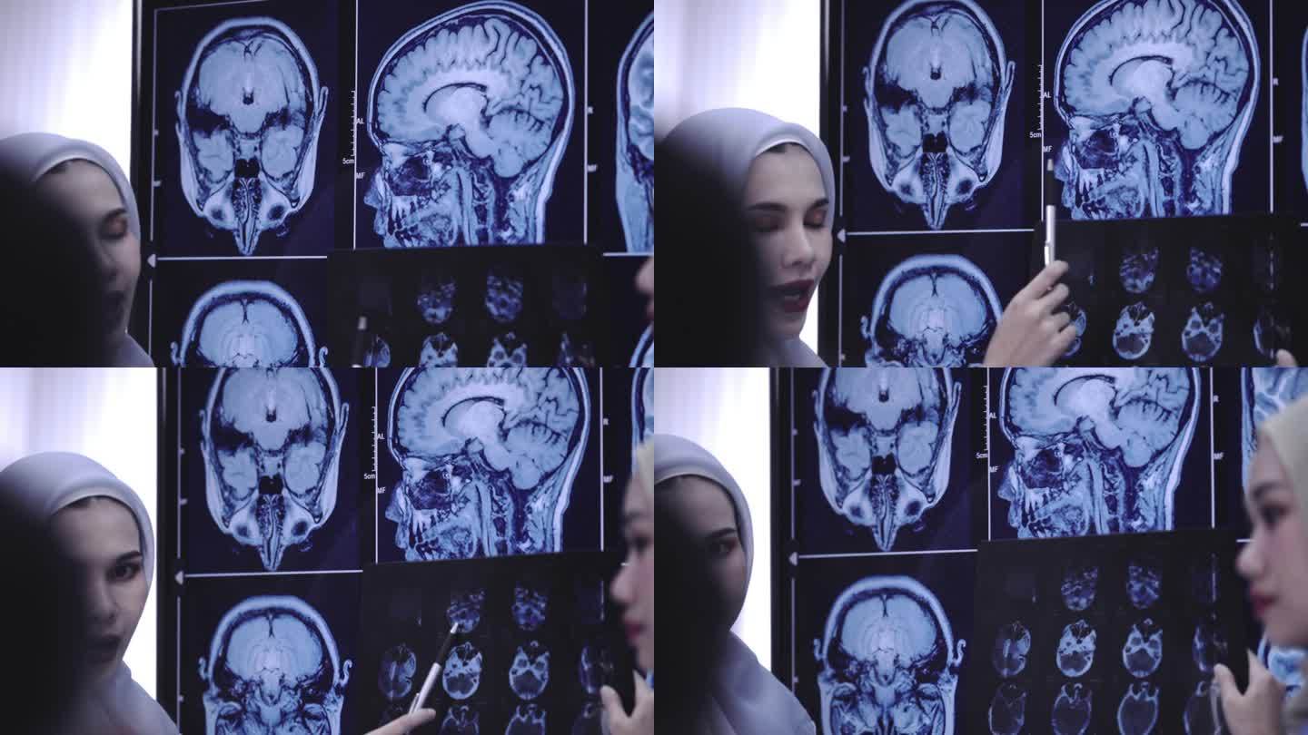 医科学生学习大脑脑部透视脑部观察观察大脑