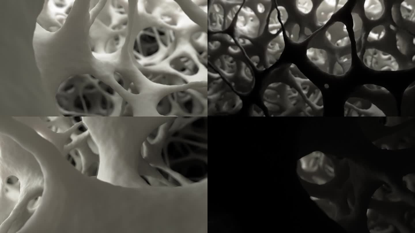 平滑的相机滑翔在3D动画中展示了电子显微镜下健康海绵状骨组织的复杂细节。