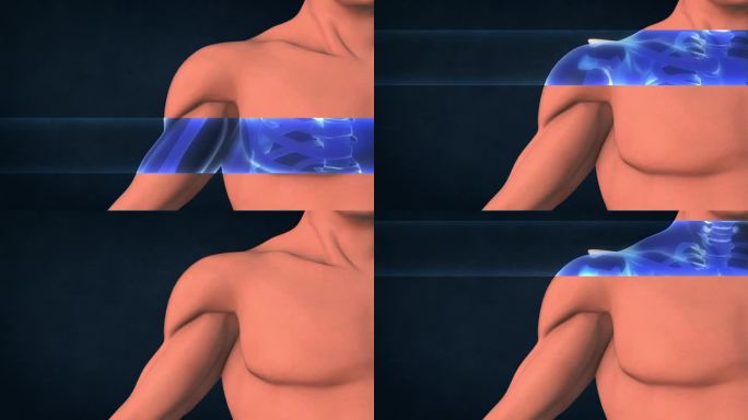人体肩部的x光片。