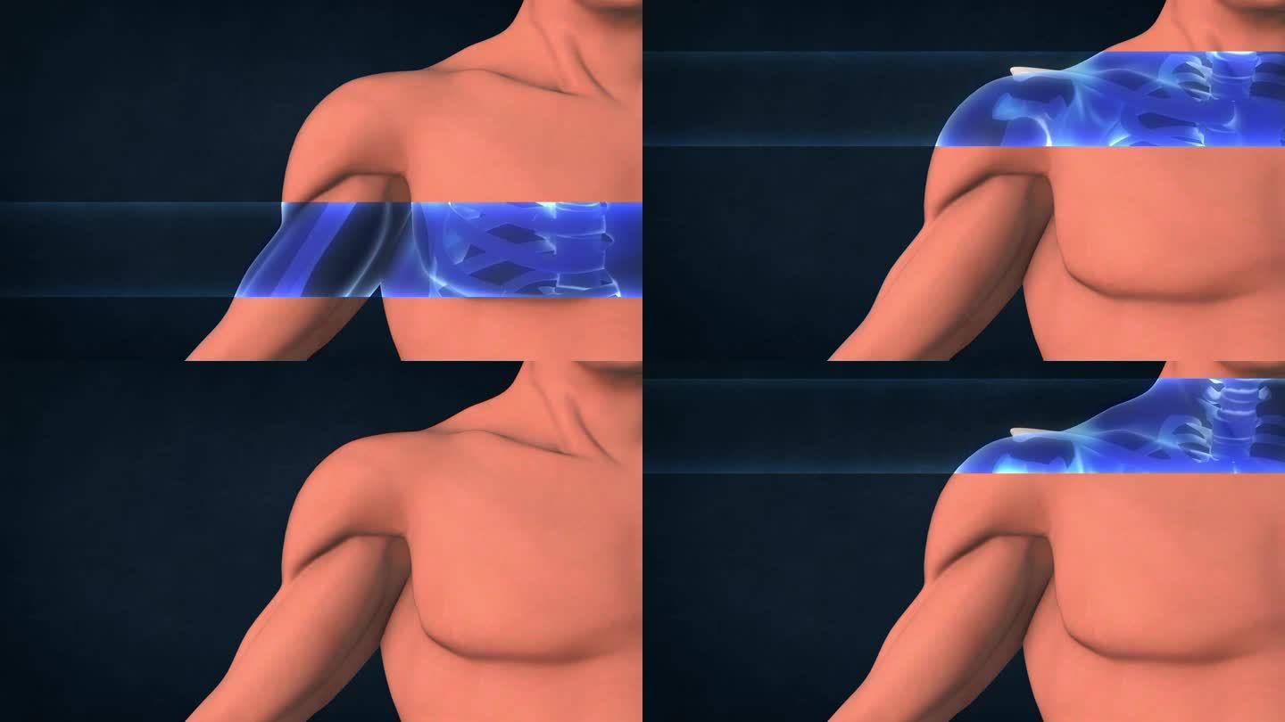 人体肩部的x光片。