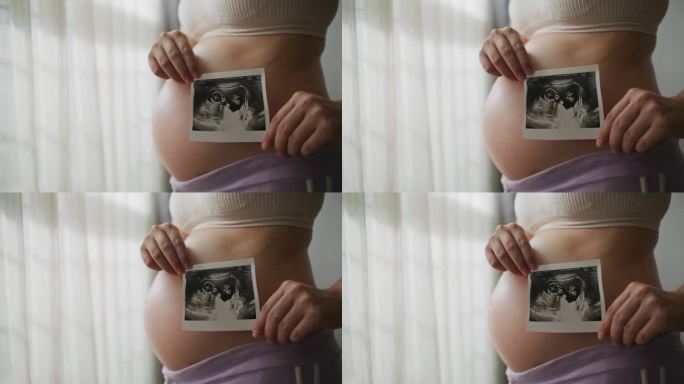 孕妇超声图像怀孕孕肚B超