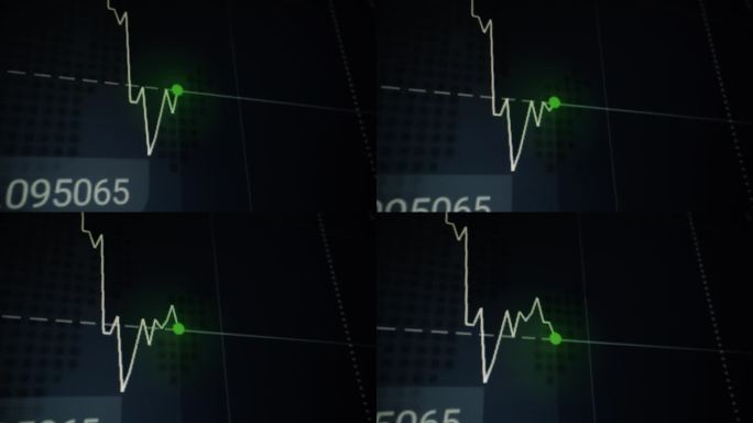 股票市场图形屏幕监视器与点的上升和下降的价格或心电图心电图在病人监护