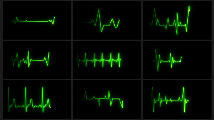 13款4K绿色粒子心电图跳动停止循环素材