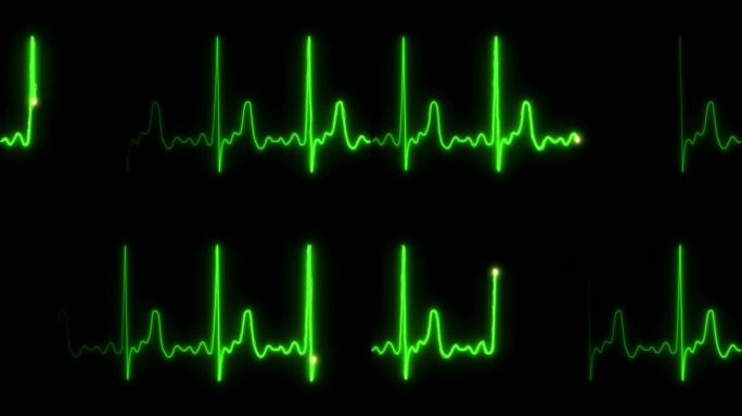 4K绿色粒子心率心电图跳动停止循环素材