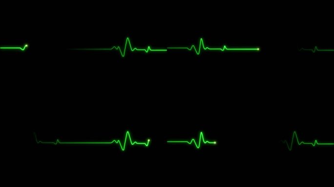 4K绿色心率心电图跳动停止循环素材