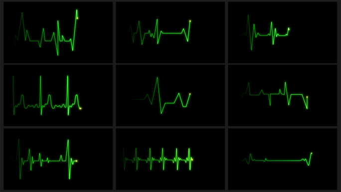13款4K绿色心率心电图跳动停止循环素材