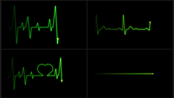 13款4K绿色心率心电图跳动停止循环素材