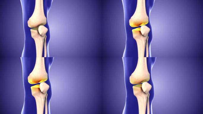 膝关节疼痛和膝关节间隙
